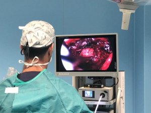 cirugía endoscópica en fusiones vertebrales