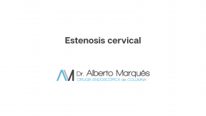 estenosis de canal cervical