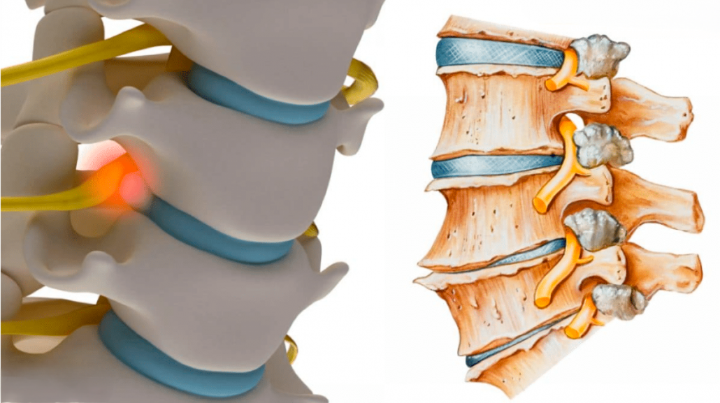 discartrosis-alberto marques